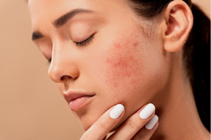 Skin care tips Skin care tips